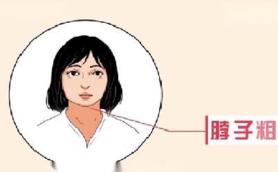 甲状腺宣传